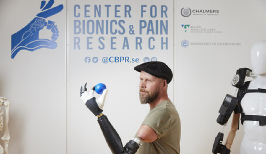imagen de Primera mano biónica completamente integrada al cuerpo de un hombre