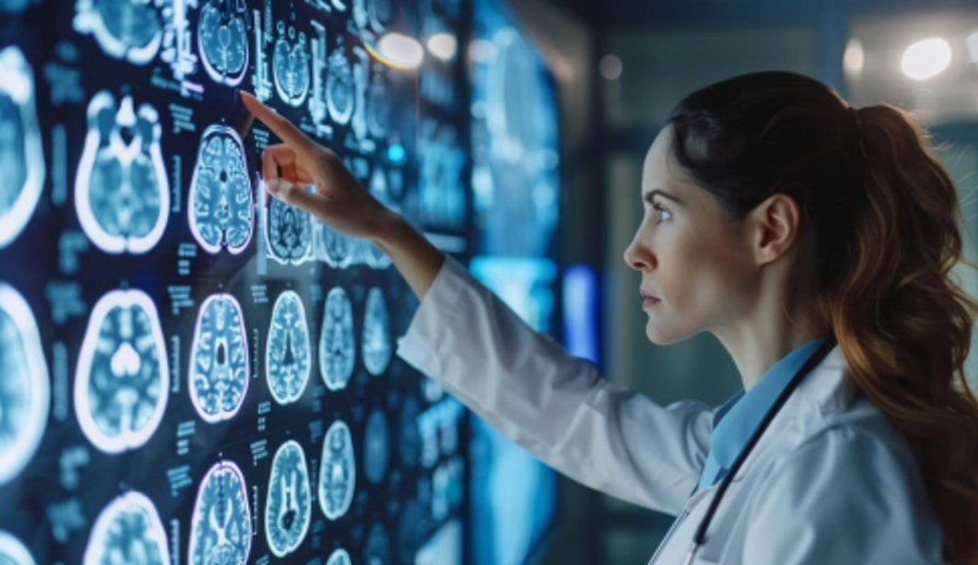 imagen de La pandemia aceleró el envejecimiento cerebral incluso en personas no infectadas, según un estudio