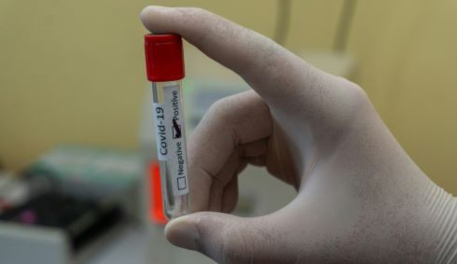 imagen de Salud Pública confirma circulación de las variantes Frankenstein y Nimbus de covid-19