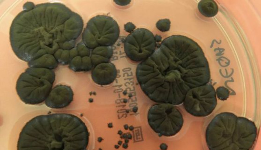 imagen de Hongos negros de Chernóbil, que sobreviven a niveles extremos de radiación, podrían ser aprovechados por la NASA