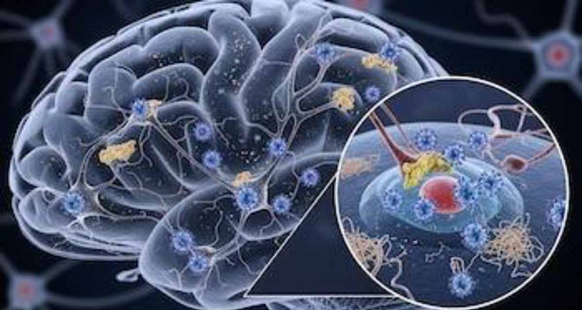 imagen de La infección por el virus del herpes podría acelerar el desarrollo del Alzheimer, según un estudio en ratones