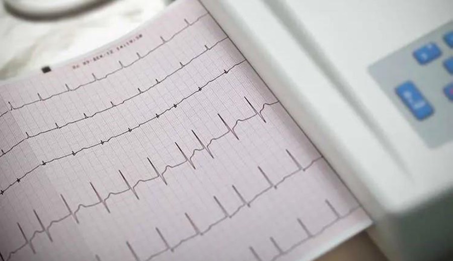 Imagen del contenido Latidos al límite: cómo prevenir la parada cardíaca y la muerte súbita en el deporte