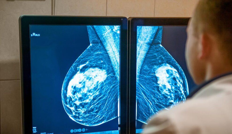 imagen de Salud Pública establece mamografías gratuitas para mujeres de 40 a 74 años